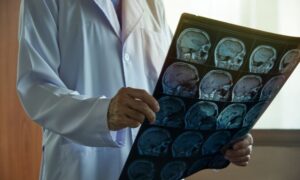 Conoce dónde estudiar neurociencia, salidas y asignaturas