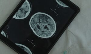 Descubre qué es la neurociencia