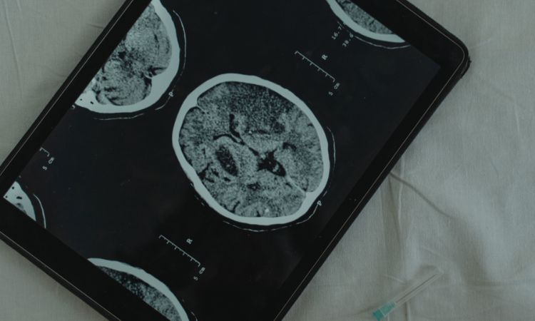 Descubre qué es la neurociencia